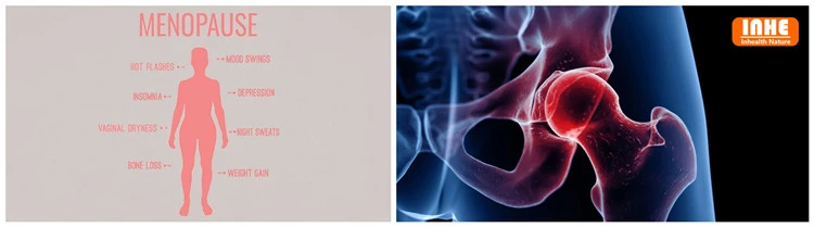 Menopausal Symptoms and Bone and Cartilage Turnover Menopausal Symptoms and Bone and Cartilage Turnover